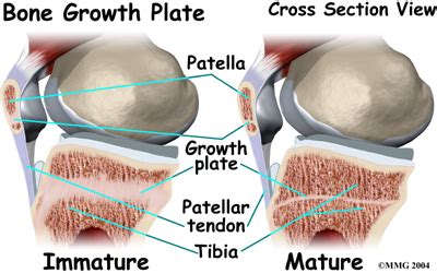 How do bones grow in diameter? Singapore Jumper's Knee Children Specialist | Singapore ...