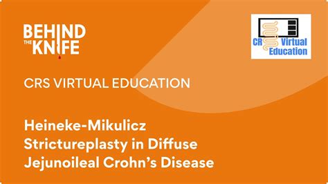 Crs Virtual Education Heineke Mikulicz Strictureplasty In Diffuse