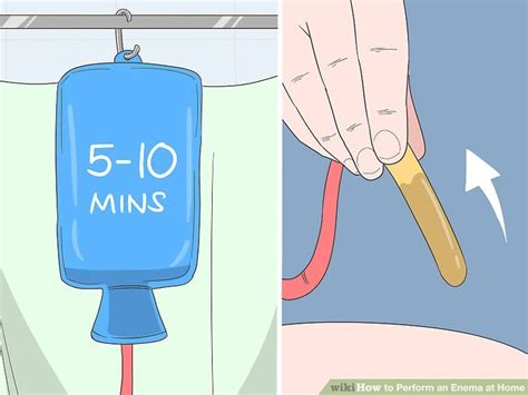 3 Ways To Perform An Enema At Home Wikihow