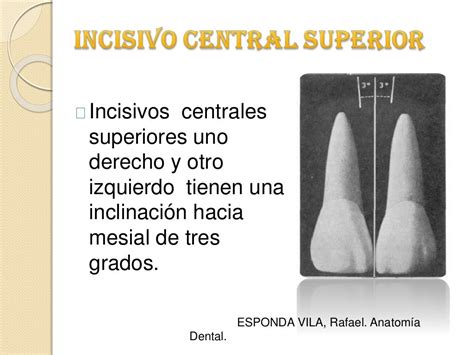 Anatomia Incisivo Central Superior
