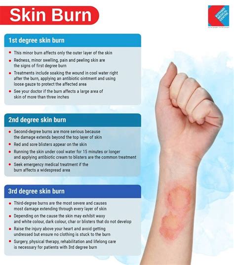 Difference Between 1st Degree Burn And 2nd Havenmyte