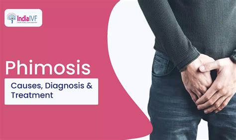Phimosis Causes Diagnosis And Treatment India Ivf