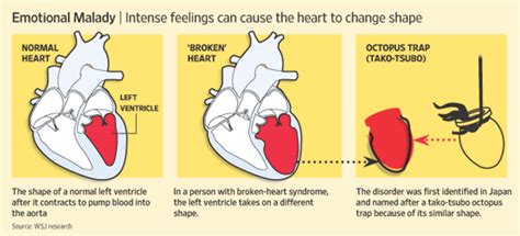 Can You Really Die From A Broken Heart Siowfa15 Science In Our