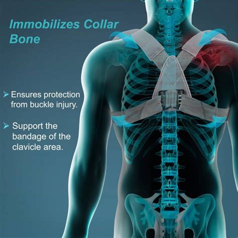 Clavicle Brace With Buckle Used In Fractures Tynor