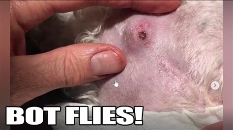 Bot Fly Removal Top 10 Bot Fly Removal Of All Time Youtube