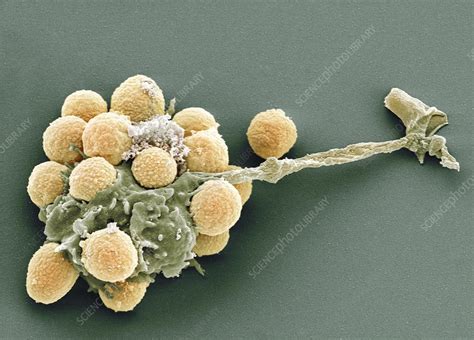 Phagocytosis Of Fungal Spores Sem Stock Image P2660123 Science