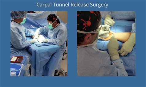 How To Treat Carpal Tunnel Syndrome Orthopedic Specialists Orthopedic Surgeons