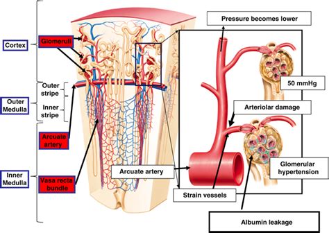 Blood vessels can be damaged by the effects of high blood glucose levels and this can in turn cause damage to organs, such as the heart and eyes, if significant blood vessel damage is sustained. Anatomical structures of the renal vasculatures and the ...