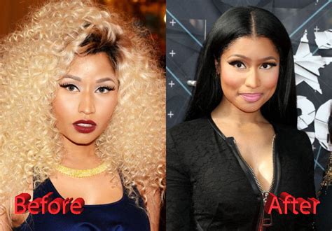 Nicki Minaj Plastic Surgery: Fact or Not?