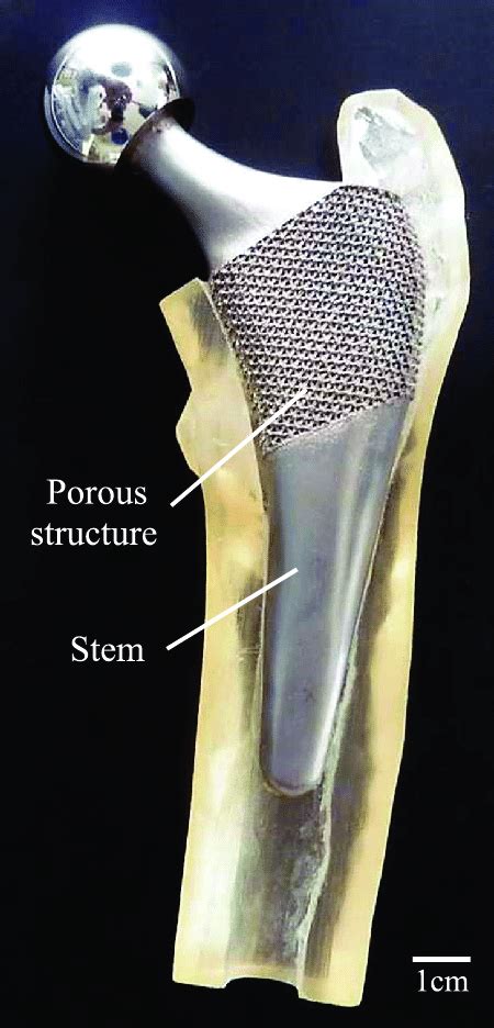 A Model Of A Tailor Made Artificial Hip Joint Fabricated By Electron