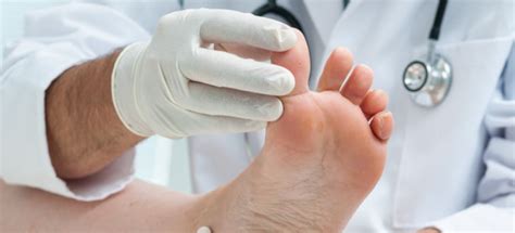 How To Tell The Difference Between A Sprained Toe And Broken Toe The
