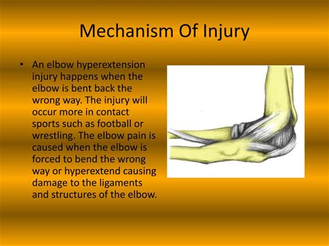 Ppt Hyperextension Of The Elbow Powerpoint Presentation Free
