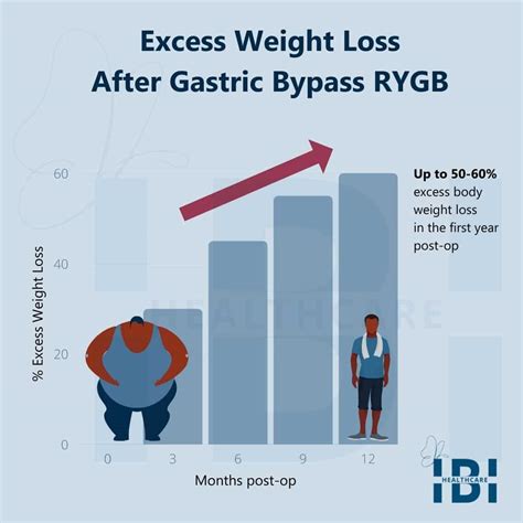 Roux En Y Gastric Bypass Surgery To Recovery Complete Guide