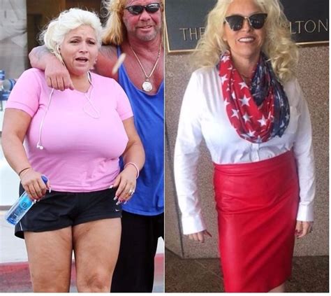 Beth Chapman Diet Tummy Tuck And Breast Reduction Surgery Beth