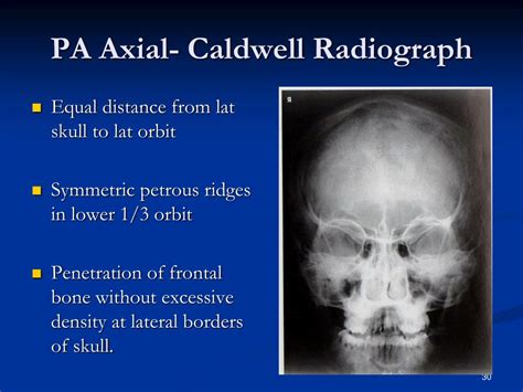 Ppt Facial Bone Anatomy And Positioning Powerpoint