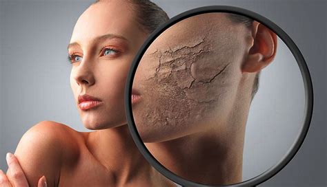 Why You Need Dead Skin Cells On Your Face Beautygeeks Beauty And Health