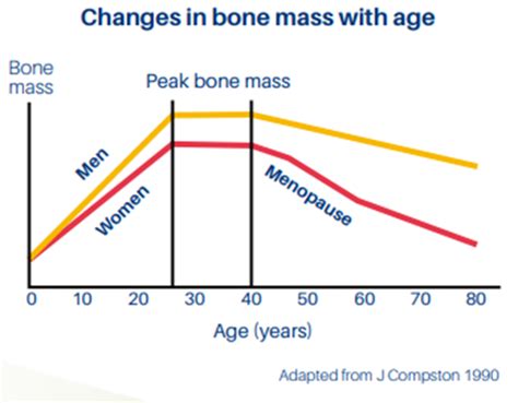 Osteoporosis Womens Health Royal College Of Nursing
