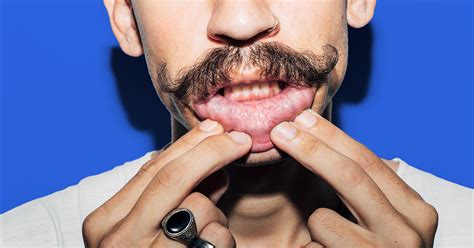What happens to the taste buds at the tip of the tongue? How to Get Rid of Canker Sores: 20 Home Remedies and ...
