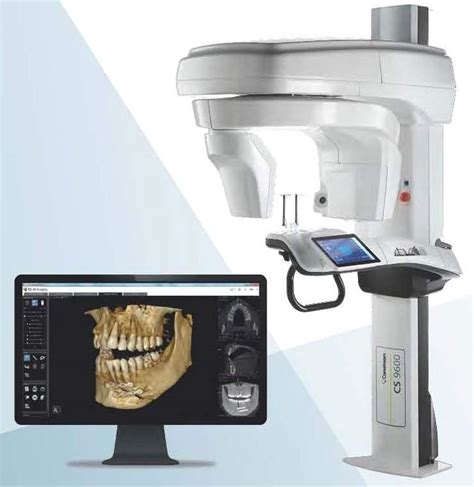 CBCT Imaging (Cone Beam Computed Tomography) Webster TX, Oral Surgery Associates