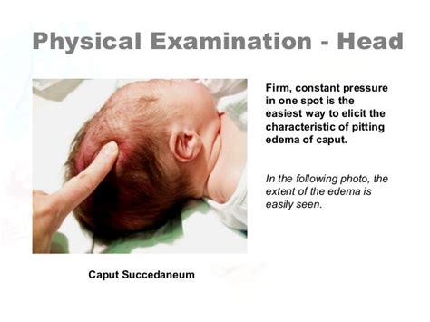 Newborn Assessment By Hadi Hospital Nicu