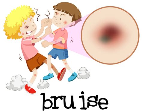 Young Boys Fighting With Magnified Bruise 297985 Vector Art At Vecteezy