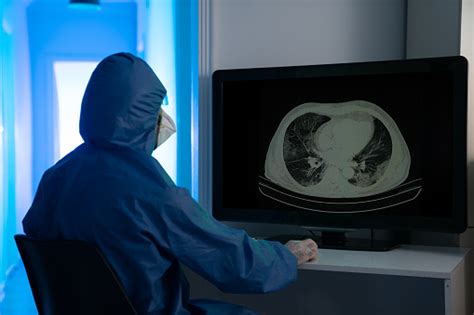 Ahli Radiologi Memeriksa Gambar Thorax Ct Pasien Di Klinik Radiologi
