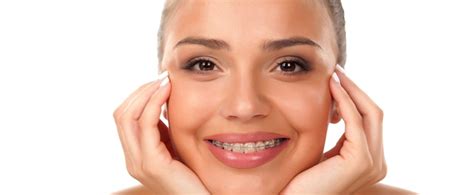 Top 3 Myths About Adult Braces Orthodontics In London Waterloo