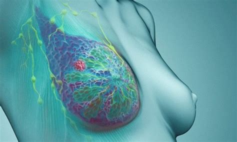 Breast Cancer Now Claims It Will Wipe Out The Disease By