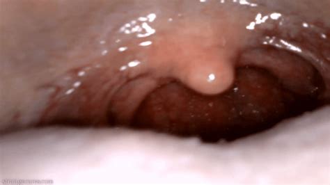 Yawning Uvula Endoscopy 720 Wmv Strangecares Clips4sale Com