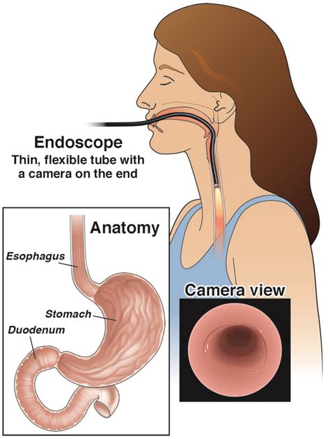 Endoscopy Upper Gi Aga Gi Patient Center