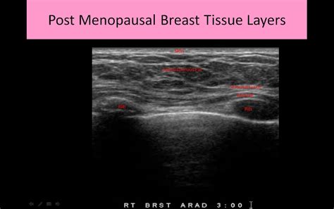 Anatomy And Physiology Of The Breast Review Of The Ultrasound Record
