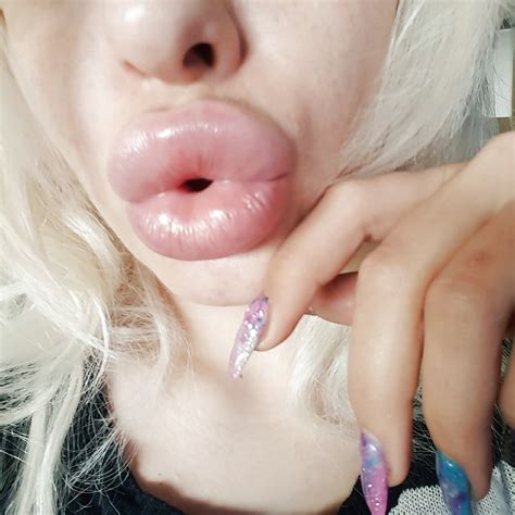 Thick Fake Plastic Bimbo Lips Pics Xhamster