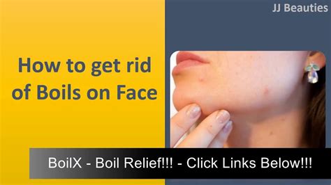 Natural Remedies For Boils On Face Boilx Homeopathic Boils