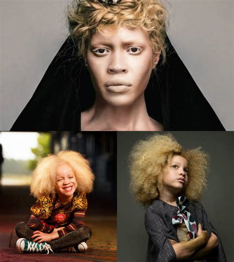 Albino Models And Black Women Hairstyles Hairstyles 2017 Hair Colors