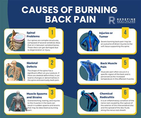 What Causes Burning Back Pain Njs Top Orthopedic Spine And Pain