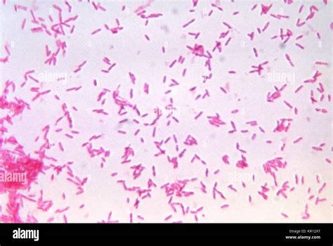 Gram Negative Anaerobic Bacteria Stock Photos And Gram Negative