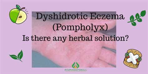 Dyshidrotic Eczema Pompholyx Causes Signs Symptoms Ayurvedic