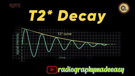 T2 Decay Process In Mri Causes Graph By Aaqib Sir Youtube