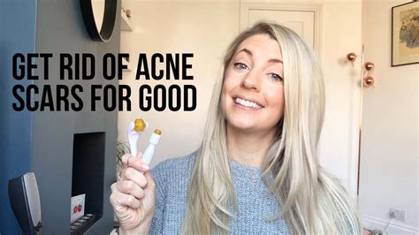 How To Completely Get Rid Of Acne Scars Dermarollingmicroneedling