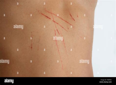 Cat Injury Blood Skin Hi Res Stock Photography And Images Alamy