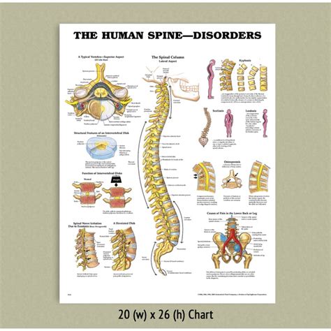 Back Talk Systems Colorado Spine Disorders Anatomical Chart Report