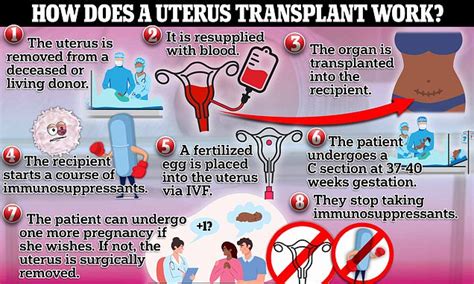 Exclusive Leading Womb Transplant Experts Say It S Medically Possible
