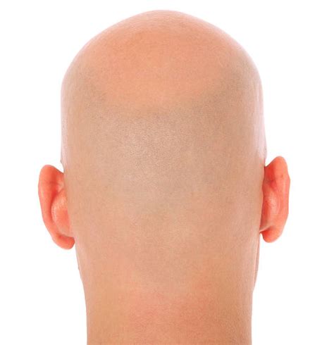 Top Bald Head Back Stock Photos Pictures And Images Istock