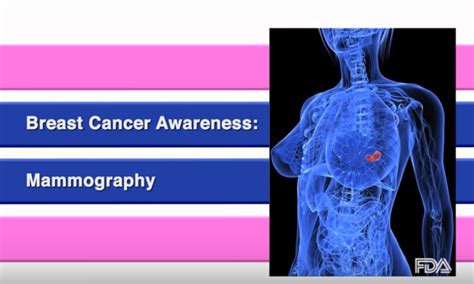 Breast Cancer Screening The Mammogram