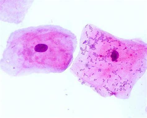 células epiteliales escamosas Foto de stock en Vecteezy