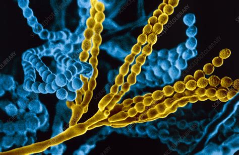 Penicillium Fungal Spores Sem Stock Image B2500983 Science