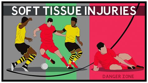Soft Tissue Injuries What Are They And Why Are They Happening More Youtube