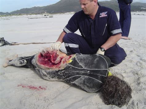 Great White Shark Attack Victim