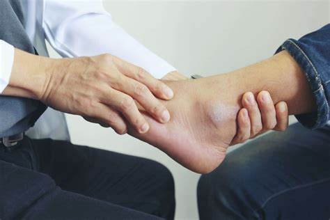 Physical Therapy After Ankle Surgery What To Expect