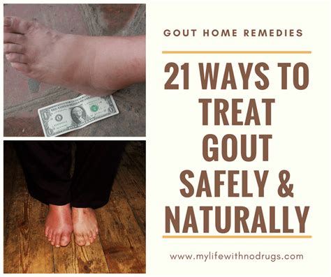 21 Home Remedies For Gout Treat Gout Safely And Naturally My Life With
